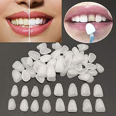 Cosmetic Resin Fake Teeth Veneers Ultra Thin Whitening Veneers