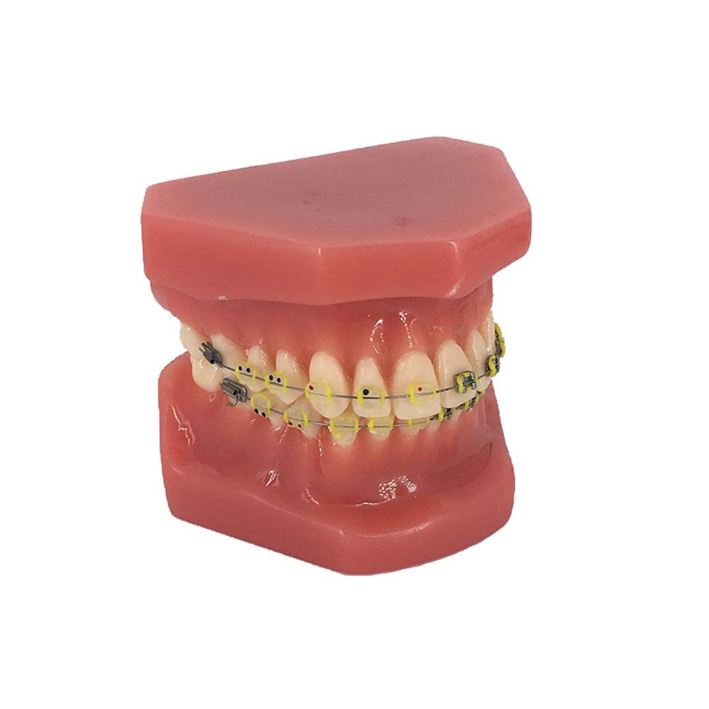 Model ortodontyczny zębów zębów z metalowymi i ceramicznymi modelem doustnym dla dentysty do komunikowania się z pacjentami, studiowanie narzędzia dydaktycznego