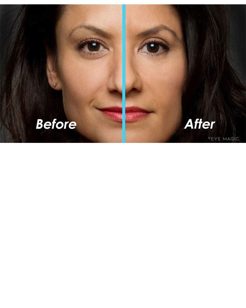 Buy Eye Magic Premium Instant Eyelid Lift (S/M Refill). Made in America