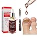 Produktbild Beito 1 STÜCK Nagel Reparaturen Ätherisches Öl Nagelerneuerungslösung Kills Pilz Schützt Vor Verfärbung Nagelpilz Behandlung für Spröde Und Gebrochene Nagel (12 ML)