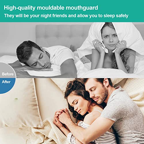 Mouth Guard For Grinding Teeth - Mouth Guard For Clenching Teeth At Night, New Upgraded Dental Night Guard Stops Bruxism For Adults & Kids Bpa Free 2 Sizes Pack Of 4 (2 Pairs) #TOP2