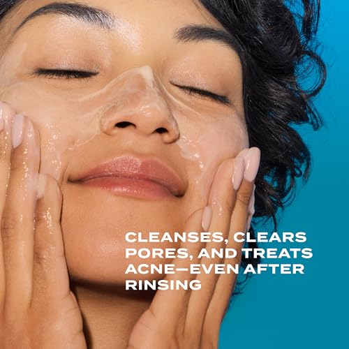The Best Face Wash for Combination Skin with Acne: A Complete Guide for Women Over 50 4 Murad Clarifying Cleanser – Salicylic Acid & Green Tea Formula for Acne, Deep Pore Cleansing, Oil Control & Breakout Prevention for Clear, Balanced, Healthy-Looking Skin – 5 Fl Oz