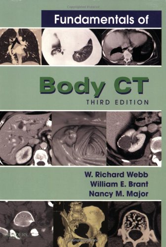 Buy Fundamentals of Body CT (Fundamentals of Radiology) — BookShops.in