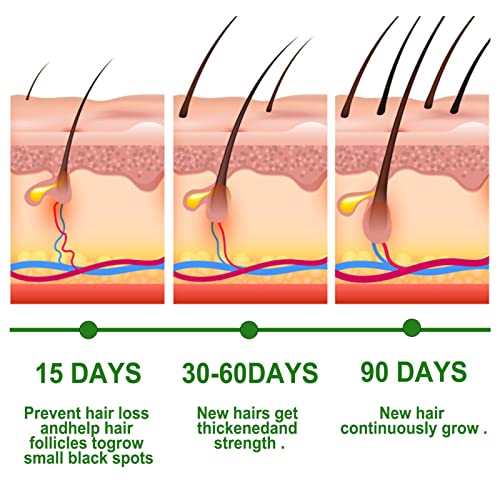 EELHOE 30ml Óleo Essencial de Crescimento do Cabelo de Alecrim Previne a Perda de Cabelo Nutrir o Co