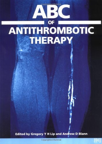 ABC of Antithrombotic Therapy (ABC Series Book 24)