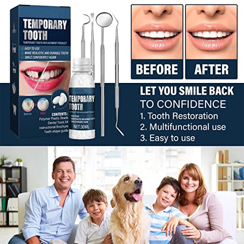 Tooth Repair Kit - Temporary Fake Teeth Replacement Kit With Dental Mirror Tools For Temporary Restoration Of Missing & Broken Teeth Replacement Dentures #TOP4