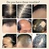 Anti-Hair Loss and Hair Growth Solution, Anti Loss Hair Conditioner, Herbal Hair Care Serum (3 Pcs Set)