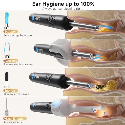 BEBIRD R1 Ultra Ear Wax Remover