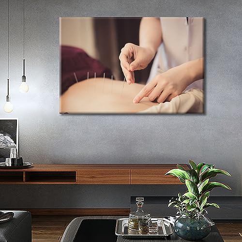 Image of TUMOVO 1 Panels Acupuncture and Moxibustion Large Wall Art Traditional Chinese Medicine Wall Art for Living Room Traditional Art Prints Giclee Print Stretched and Framed Ready to Hang (24 inch Wx36 H)