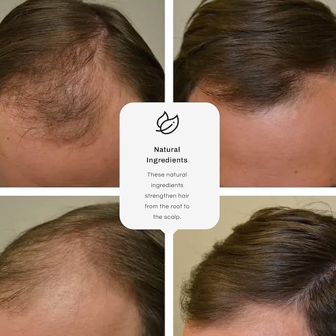 Miniatura 5 de Delta Hair Regrowth Spray