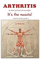 ARTHRITIS & other joint pains & neuralgias: It's the muscle -and it can be cured 295155009X Book Cover