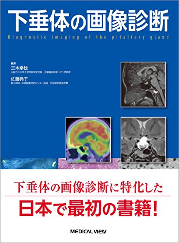 オライリー 無料電子書籍 下垂体の画像診断 バイ
