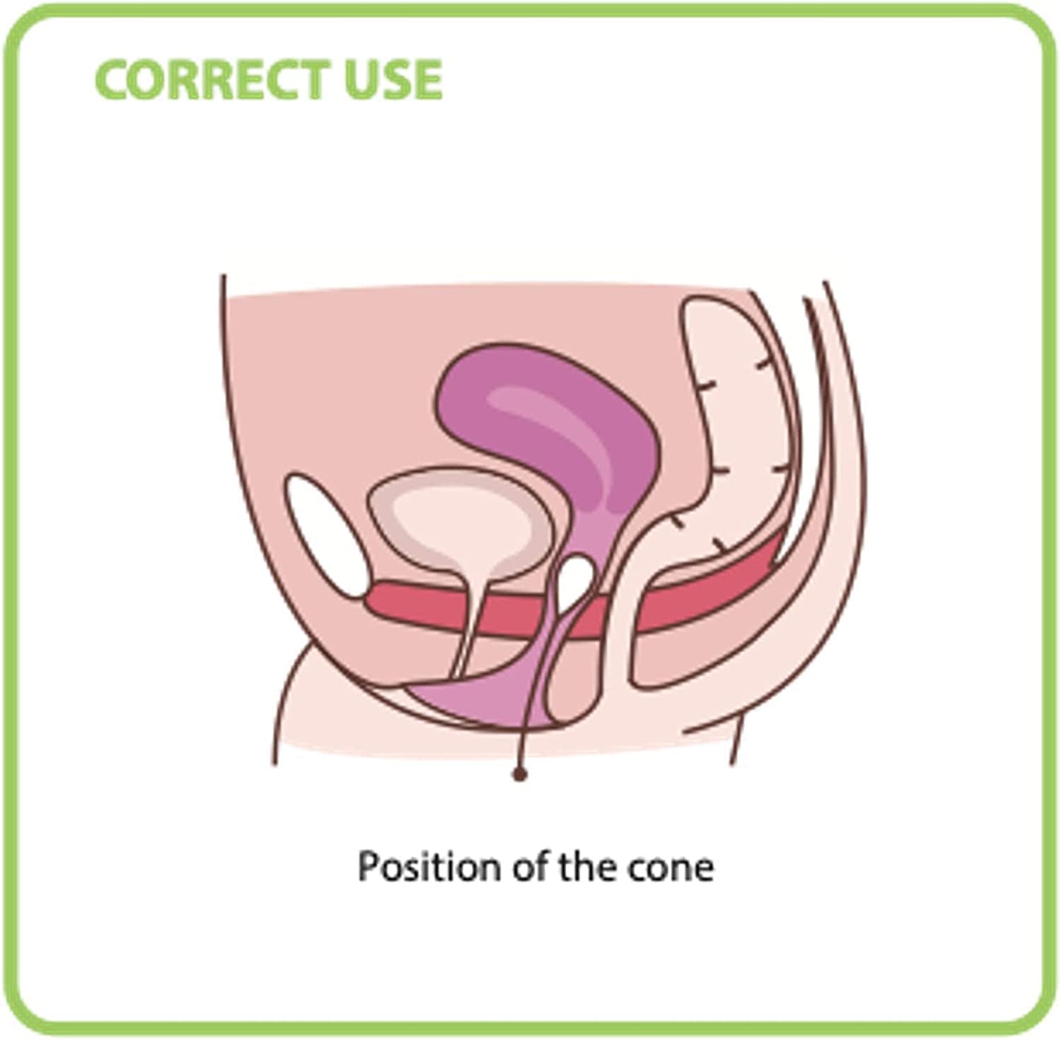 3 Coni Palline Kegēl - Dispositivo Medico Brevettato per la Riabilitazione del Pavimento Pelvico - Ginnastica Pelvica per Incontinenza Urinaria, per Post Parto