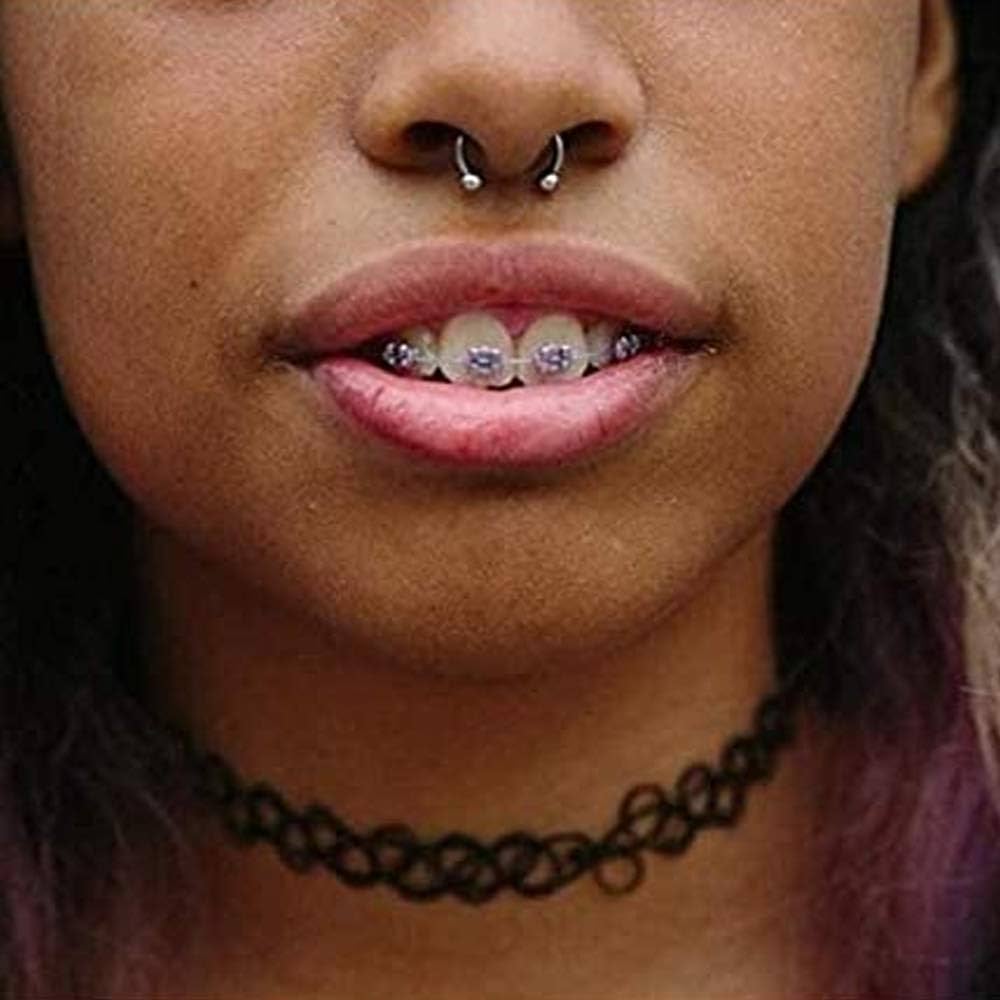 Update 144+ fake braces with earring backs latest seven.edu.vn