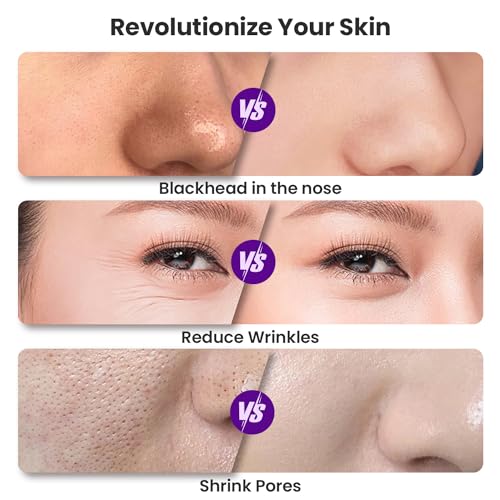 UNOISETION Rechargeable Micro Dermabrasion Tool