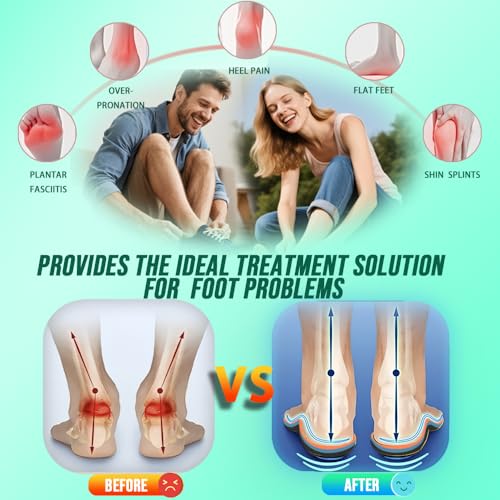 Image of Plantar Fasciitis Relief Insoles Men Women High Arch Support Shoe Inserts,240+lbs Comfort EVA Orthotics Insert Absorb Shock Work Boot Shoe Insole for Flat Feet, Pronation, Heel & Foot Pain
