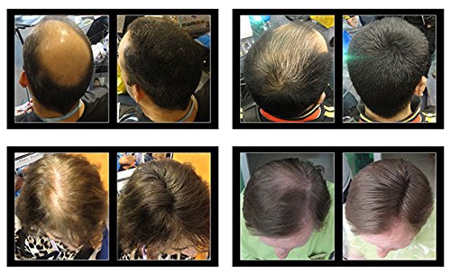 3 x Allure Hair Building Fibers (HBF) (22g) (Black)