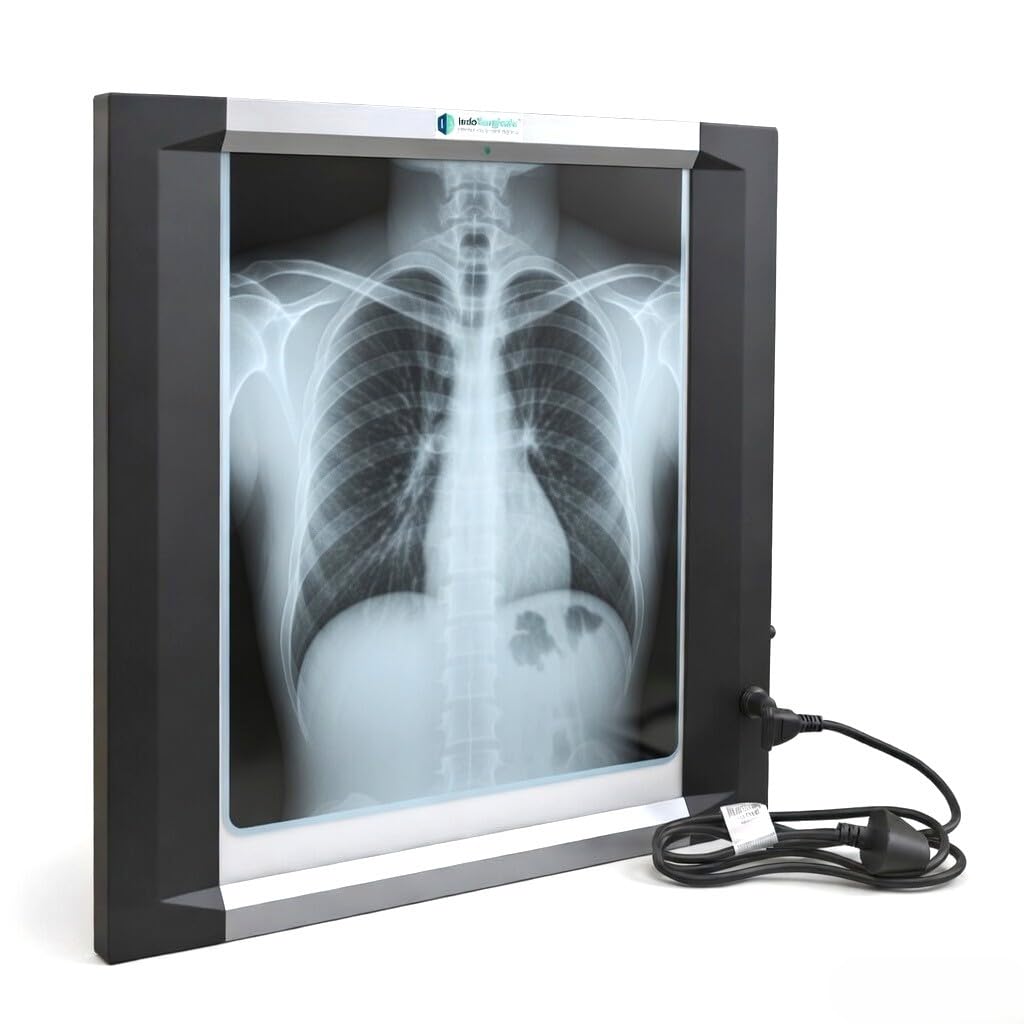 IS IndoSurgicals Ultra Slim LED, Single Film X-Ray View Box (25mm Thickness) with Sensor & Dimmer for Brightness Adjustment-image-25