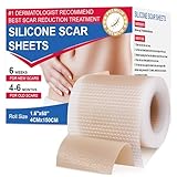 DEZEHUI Pansements en silicone pour cicatrices, 4 cm x 150 cm, réutilisable, en silicone, les Brûlures, l'acné, etc. Blessures, Césarienne