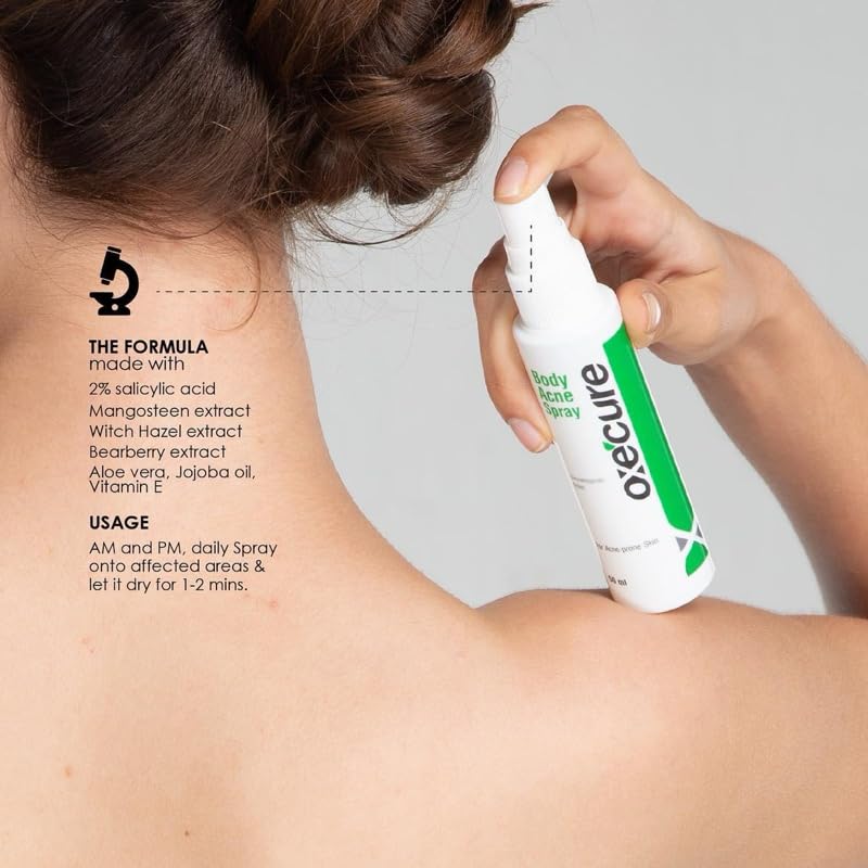 Oxe-cure Body Acne Spray 50 ml