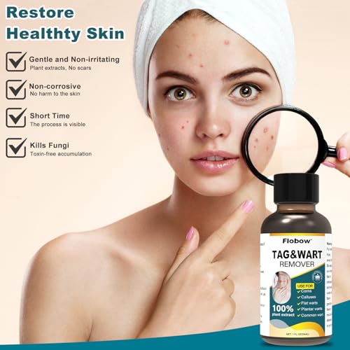 Image of Skin Tag Remover,Wart Remover Freeze Off Liquid with 17% Salicylic Acid - Fast-Acting Freeze Off Treatment for Common & Plantar Warts,Flat Wart, Corns - for Feet, Hands & Body 1Ounce