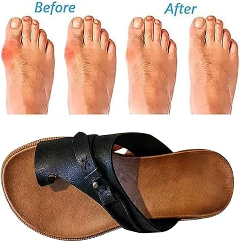 Women Comfy Sandal Toe Correction Sandal Breathable Casual Orthopedic Platform Soft Sole Sandals with Arch Support Ladies Summer Beach Travel Shoes Leather Flat Heel Flip Flops4