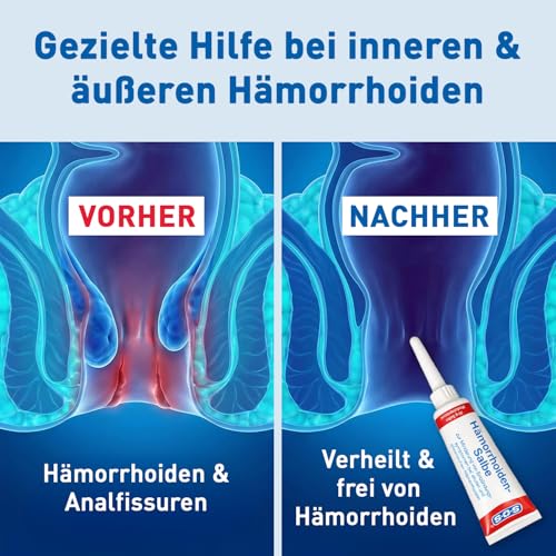 SOS Hämorrhoiden-Salbe (30g) – lindert Brennen, Juckreiz & Entzündungen - schmerzfreie Anwendung - mit Dexpanthenol & Aloe Vera - fördert die Heilung – Fördert Wundheilung auch bei Analfissuren