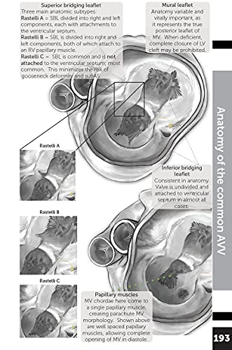 Boston Children's Hospital Cardiac ICU Manual For Bedside Providers - an illustrated handbook of congenital heart disease