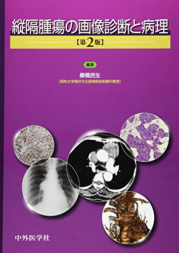 楽天 無料電子書籍 縦隔腫瘍の画像診断と病理 バイ
