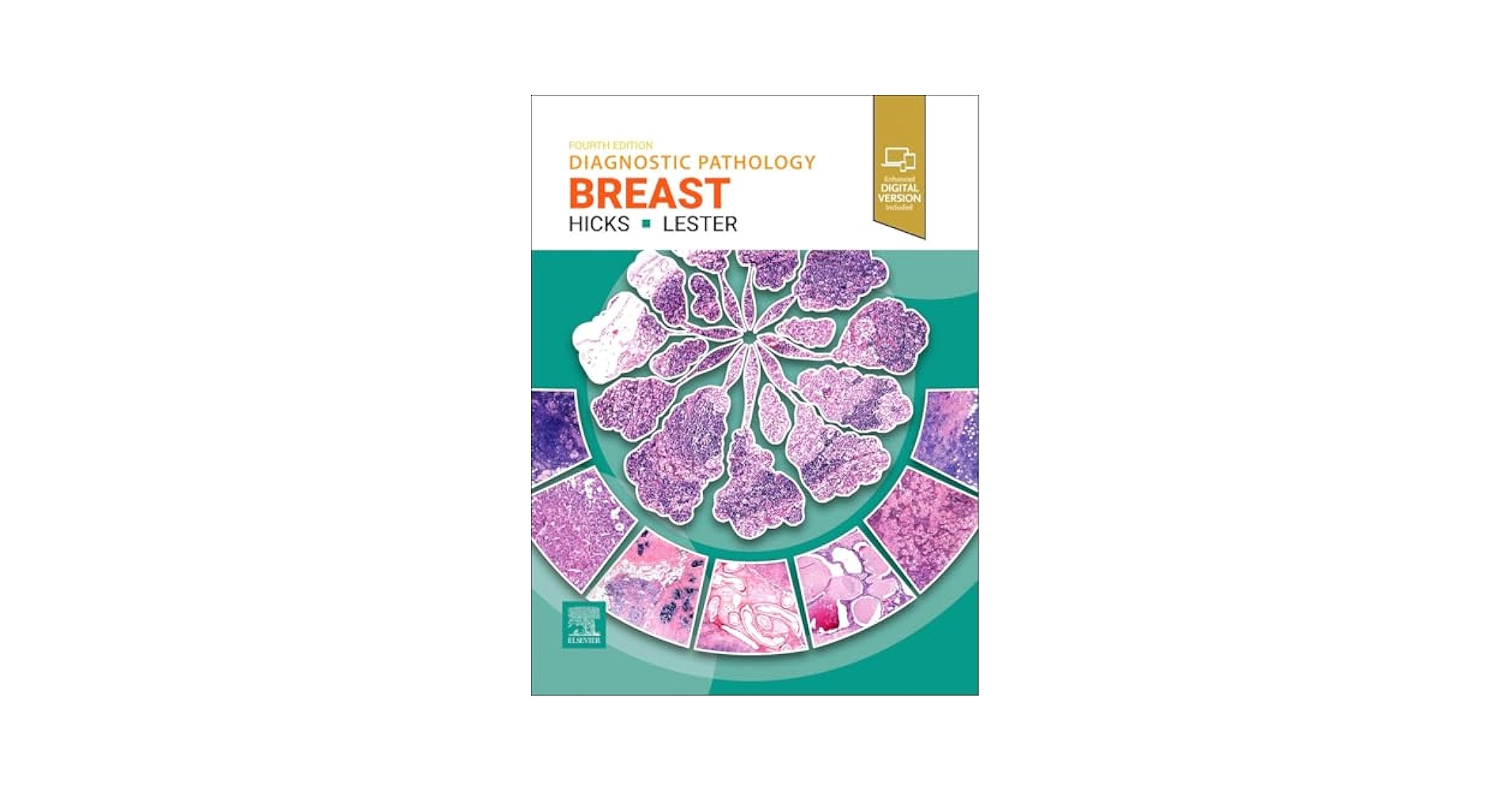 Diagnostic Pathology: Breast: 9780443286810: Medicine