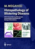 Histopathology of Blistering Diseases: With Clinical, Electron Microscopic, Immunological and Molecular Biological Correlations Textbook and Atlas: ... Correlations (Advanced Texts in Physics)