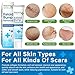 Keloid Bump Removal, Keloid Scar Treatment Cream, Anti-Scarring & Rapid Repair, Suitable for All Skin Types