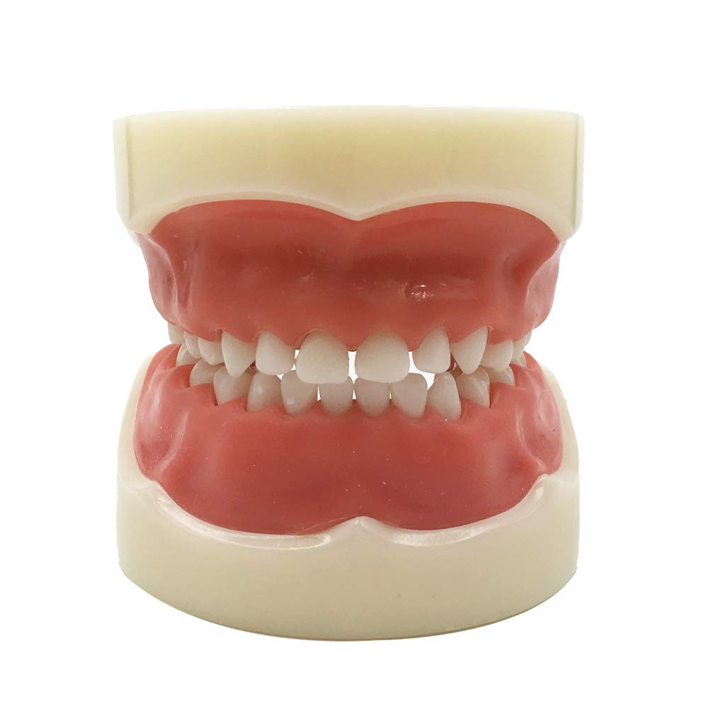 Amazon.com: Typodont Child Teeth Model, with 24pcs Removable