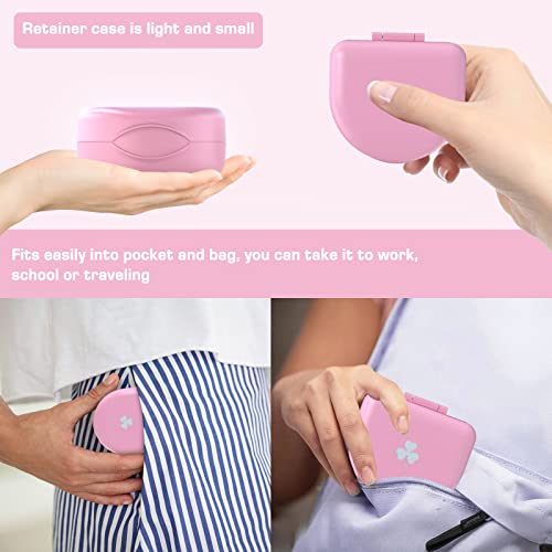 Retainer Case Denture Case: Bvn Orthodontic Dental Case, Slim Braces Case, Mouth Guard Case, Denture Box, Teeth Aligner Case, Night Guard Case Container Storage Holder Pink #TOP3