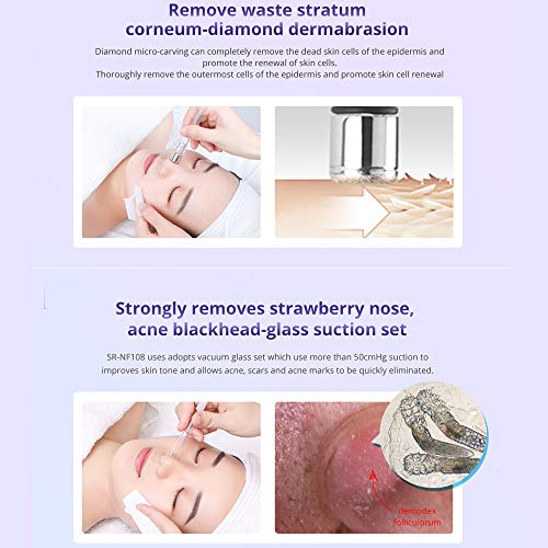 Sextupole Diamond Microdermabrasion Machine Professional 3 In 1 Diamond Dermabrasion Facial Beauty Machine Facial Care Salon Equipment For Blackhead Removal Skin Care & Diamond Microdermabrasion Replacement Tips #TOP3