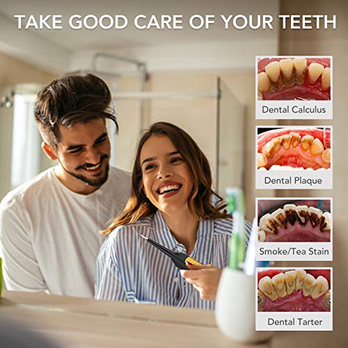 Electric Dental Plaque Calculus Remover Tool Kit - Tooth Scraper Tartar Removal Cleaner - Teeth Cleaning Kit with 2 Replacement Heads, Stains Plaque Remover with LED Display for Adult & Kids - Thumbnail 2