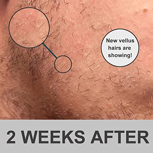 Rullo per la crescita della barba, 0,5 mm, in