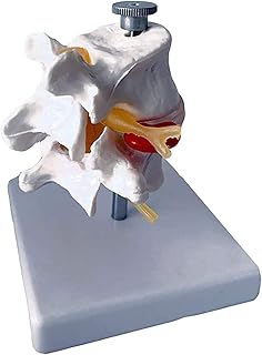 1: 1 Medical Spine Model Disc Display Human， Lumbar Spine HERNIATION Model， Human Termination Disc Modeluseful SaiFei