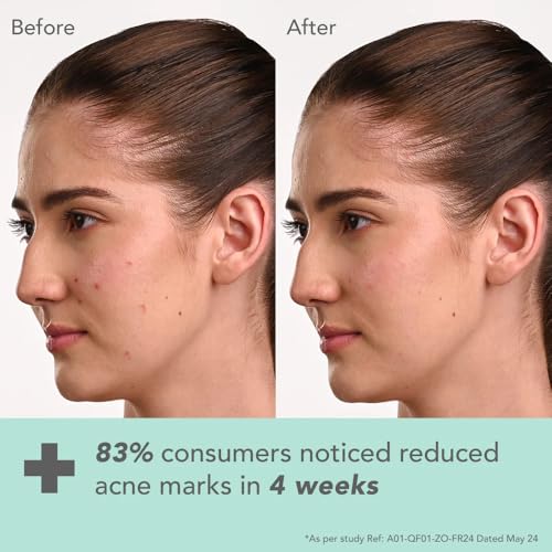 Lotus Herbals Dermabotanics Kojic Acid + Multi Berry Hi-Dose Serum|Reduces Pigmentation & Dark Spots|Calms Redness|Made With Dermatologists|Non-Irritating|Ph 5.5|Suitable For Sensitive Skin|28Ml - Image 5