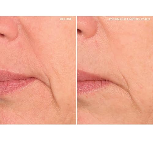 Miniatura 3 de SiO Beauty Super LipLift  Parches antiarrugas para sonrisas y labios suministro de 4 semanas parches de silicona suavizantes durante la noche para