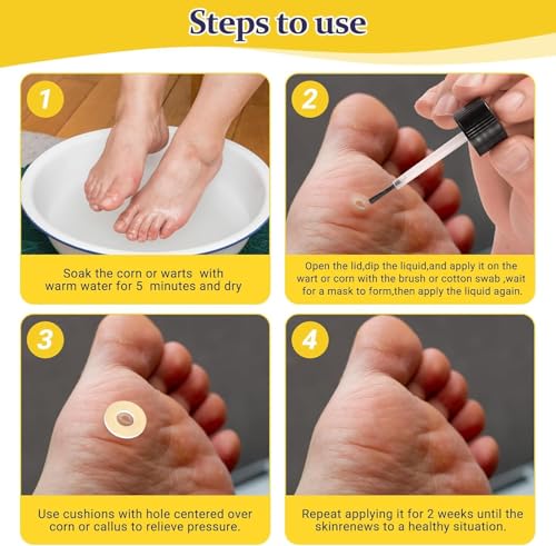 Image of Wart & Corn Remover Liquid with Salicylic Acid, Fast Acting Wart Removal for Plantar Wart, Flat Wart, Common Wart, Corn, Callus