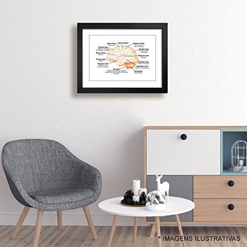 Quadro Medicina Anatomia Cerebro Humano Medico Decorativo Clinica Hospital Consultorio Moldura e Pas