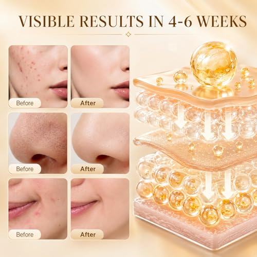 Turmeric Kojic Acid Cleansing Pads For Face, 60 Pcs Kojic Acid And Turmeric Cleansing Pads For Exfoliation, Turmeric Pads For Face Cleansing — view 5