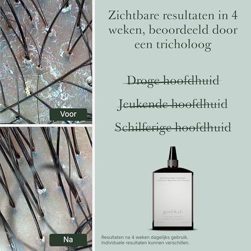 CeraVe Anti-roos Shampoo – Salicylzuur & Ceramiden - View 1