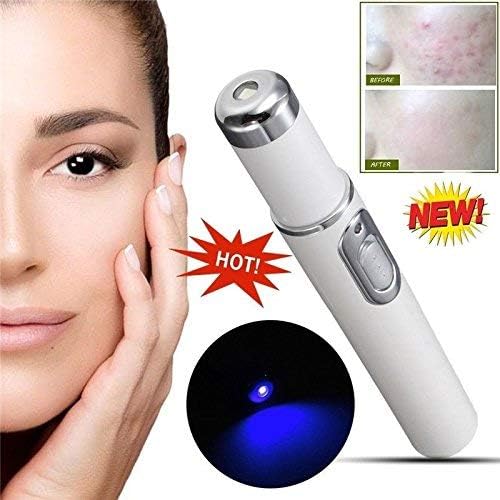 Lovelop Spider Vein Eraser Powerful Anti-varicose Veins Removal Pen