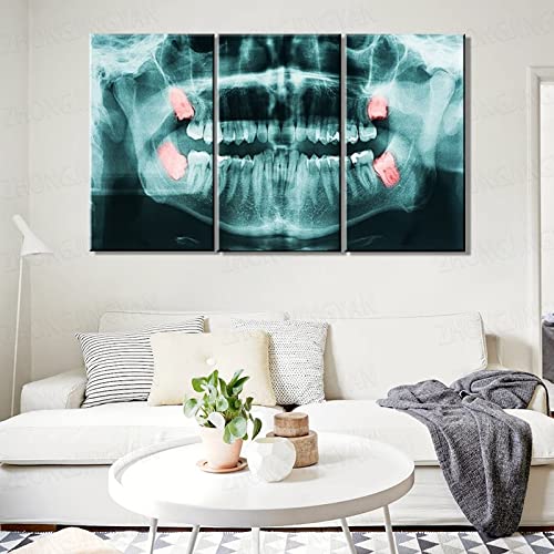 Cuadros en Lienzo Decorativos para Clínicas Dentales Arte de Pared Moderno Radiografía Muelas