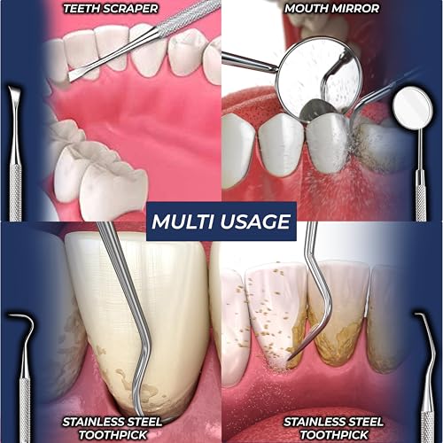 OCBA Zahnarzt Instrumente Zahnpflege Set 4Pcs Dental Kit Edelstahl Zähne Kit Professionelle Zahnsonde Zahnhygiene Tools Mundspiegel Zahnstein Schaber