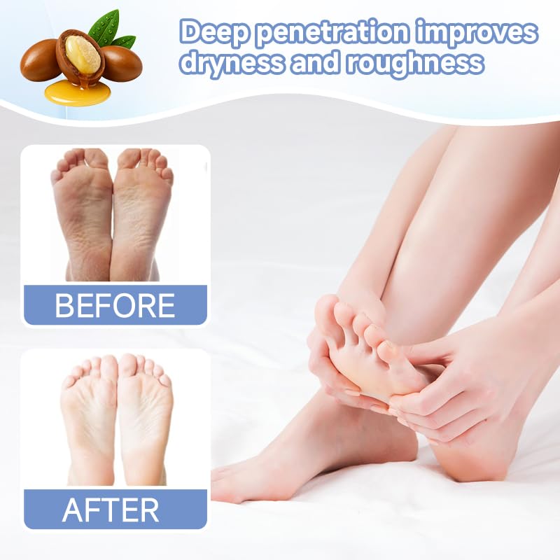 6Pairs PDRN & Collagen & Niacinamide Foot Mask | Foot Peeling and Dead Skin Removal*, Relief Dry and Cracked Feet Skin | Urea, Shea butter, Coconut oil, Salicylic Acid, Hyaluronic | K-Beauty Feet Care