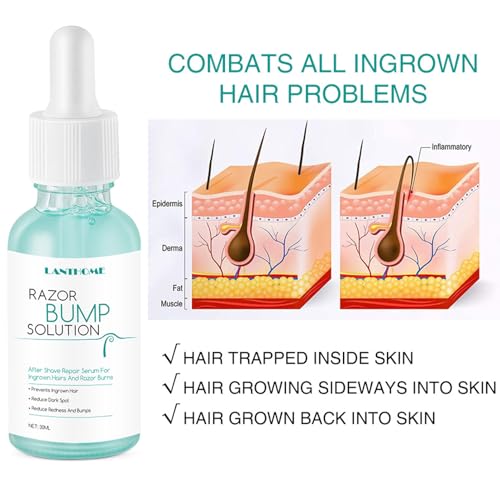 Ingrown Hair Reduction Serum,Ingrown Hair Serum For Man and Women,Gentle to Redness And Razor Bump Stopper Solution Dark Spot Corrector After Shave Repair Serum For Ingrown Hair,30ml - Image 5