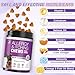Dog Allergy Chews 200ct - Dog Allergy and Itching Skin Relief Anti Itch Aller Immune Bites for Dogs licking Itching Paws Treatment Itchy Relief Chew Probiotics Vitamins for Skin and Coat Allergies